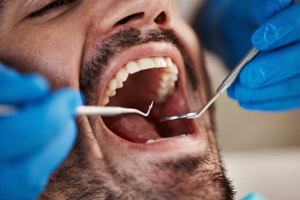 Best Same-Day Emergency Dental Services in Aragon, GA