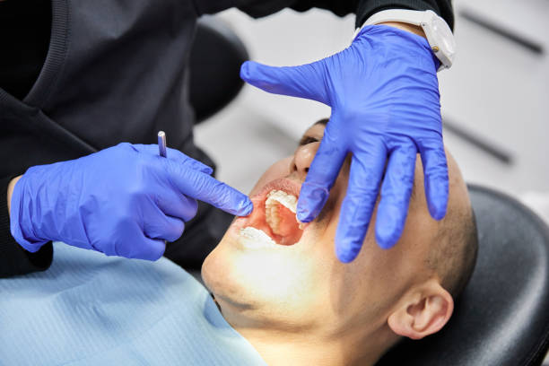 Best Emergency Tooth Extraction in Aragon, GA