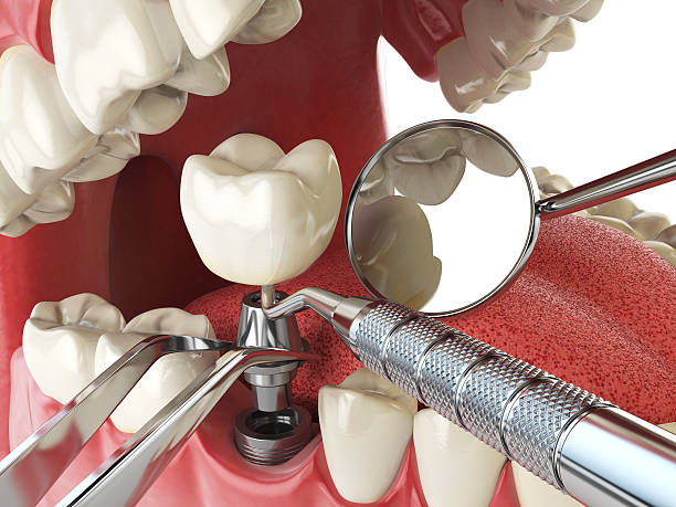 Best Urgent Care for Lost Fillings or Crowns in Aragon, GA